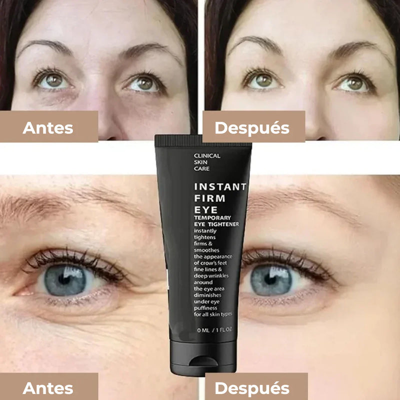 Crema Rejuvenecedora CELYN 🌟 (30 ml) ¡Rejuvenece Tu Mirada ! 🌸💖