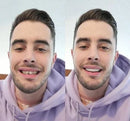 Carillas Dentales Snap On Smile (Incluye las 2)