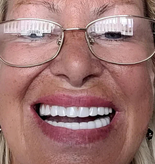 Carillas Dentales Snap On Smile (Incluye las 2)